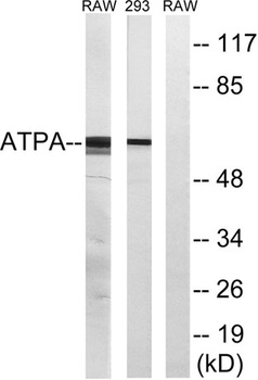 ATP5A rabbit pAb Antibody