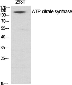 ATP-citrate synthase rabbit pAb Antibody