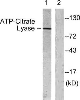 ATP-citrate synthase rabbit pAb Antibody