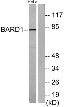 BARD1 rabbit pAb Antibody