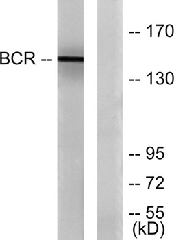 Bcr rabbit pAb Antibody