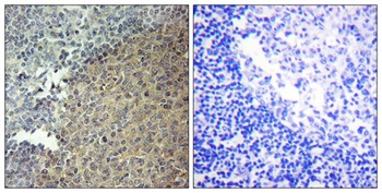 BLNK rabbit pAb Antibody