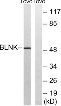 BLNK rabbit pAb Antibody