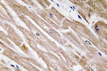 BMP-5 rabbit pAb Antibody