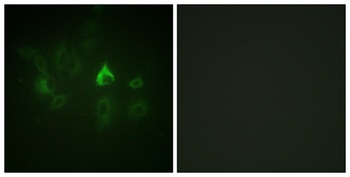 Bmx rabbit pAb Antibody
