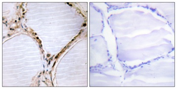 Bmx rabbit pAb Antibody