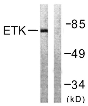 Bmx rabbit pAb Antibody