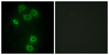 Bmx rabbit pAb Antibody