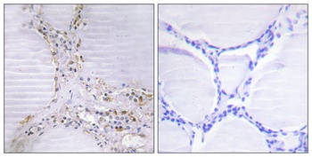 Bmx rabbit pAb Antibody