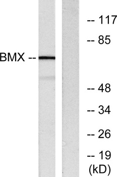 Bmx rabbit pAb Antibody