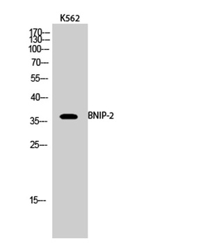 BNIP-2 rabbit pAb Antibody