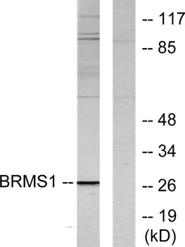 BRMS-1 rabbit pAb Antibody