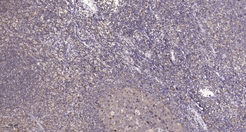 BRMS-1 rabbit pAb Antibody