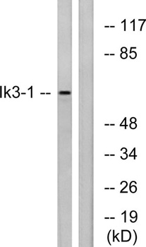 Cables1 rabbit pAb Antibody