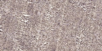 Cables1 rabbit pAb Antibody