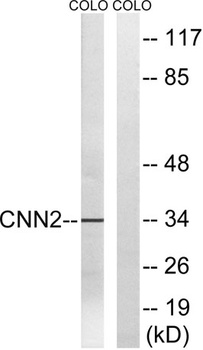 Calponin 2 rabbit pAb