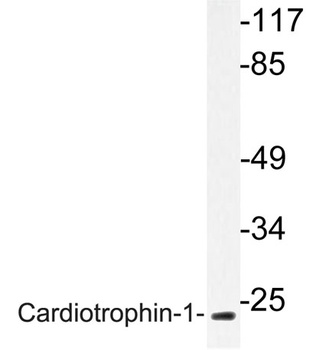 Cardiotrophin-1 rabbit pAb Antibody