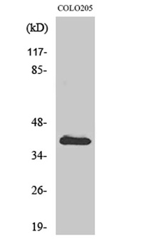 CARP rabbit pAb Antibody