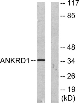 CARP rabbit pAb Antibody