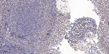 CARP rabbit pAb Antibody