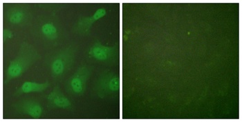 CAS rabbit pAb Antibody
