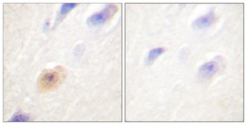 CAS rabbit pAb Antibody
