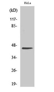 Casein Kinase IIα rabbit pAb Antibody