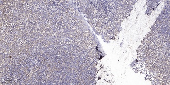Casein Kinase IIα rabbit pAb Antibody