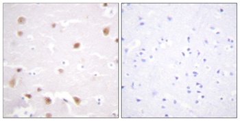 Casein Kinase IIβ rabbit pAb Antibody