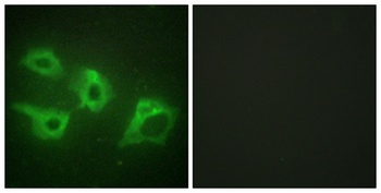 Casein Kinase Iα rabbit pAb Antibody