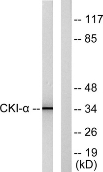 Casein Kinase Iα rabbit pAb Antibody