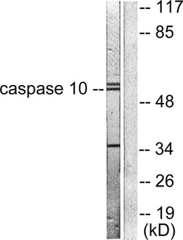 Caspase-10 B/D rabbit pAb Antibody