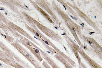 Caspase12 rabbit pAb Antibody