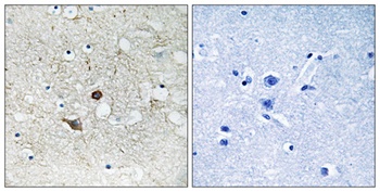 Caspase-2 rabbit pAb Antibody