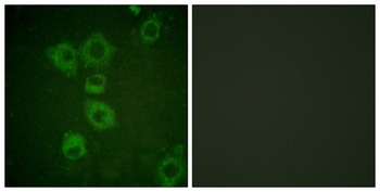 Caspase-6 rabbit pAb Antibody