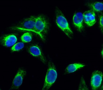 Catenin-α E/N rabbit pAb Antibody