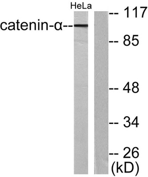 Catenin-α E/N rabbit pAb Antibody