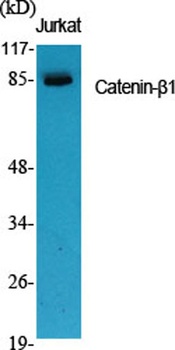 Catenin-β1 rabbit pAb Antibody