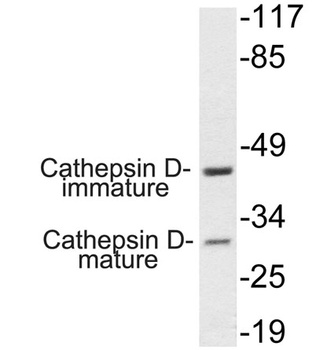 Cathepsin D rabbit pAb Antibody