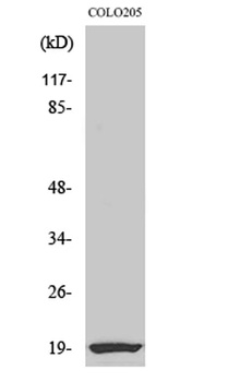 CBP20 rabbit pAb Antibody