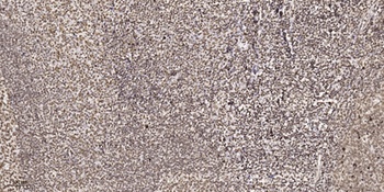 CBP20 rabbit pAb Antibody