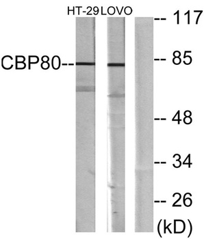 CBP80 rabbit pAb Antibody