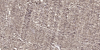 CBP80 rabbit pAb Antibody
