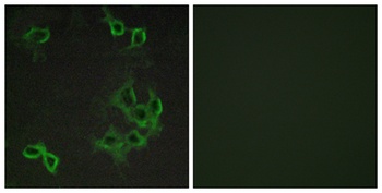 CCRL1 rabbit pAb Antibody
