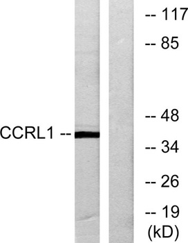 CCRL1 rabbit pAb Antibody
