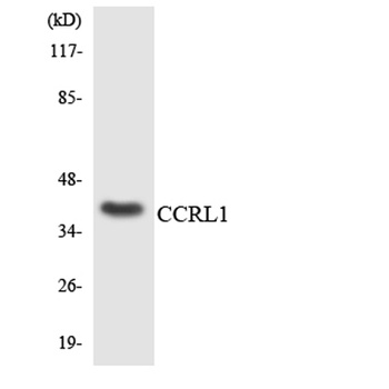 CCRL1 rabbit pAb Antibody