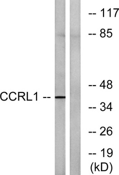 CCRL1 rabbit pAb Antibody