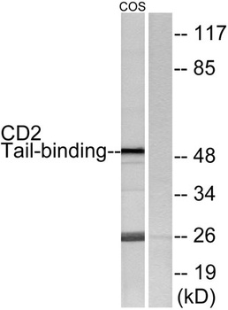 CD2BP2 rabbit pAb Antibody