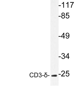 CD3-δ rabbit pAb Antibody