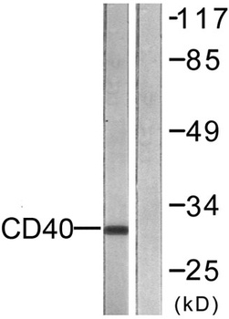 CD40 rabbit pAb Antibody